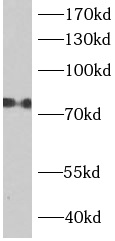      anti- ACSL1 antibody