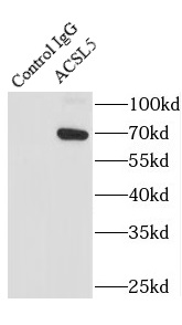 ACSL5抗体