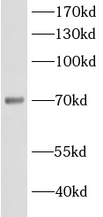 anti- ACSL5 antibody