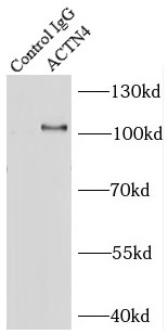 anti- ACTN4 antibody