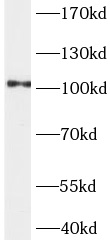 anti- ACTN4 antibody