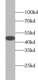      anti-ACADM antibody