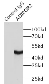 ADIPOR2抗体