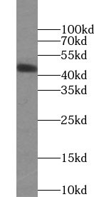 anti-ADIPOR2 antibody