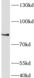 anti-AFAP1L1 antibody