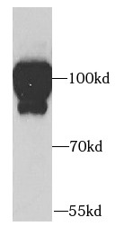      anti- ADAM12 antibody