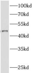      anti- ADHFE1 antibody