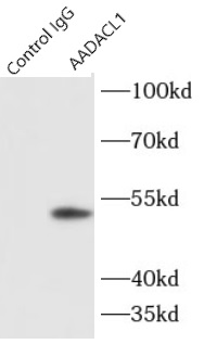      anti- AADACL1 antibody