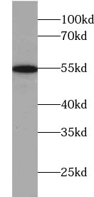      anti- AADACL1 antibody