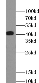      anti- ABHD12B antibody