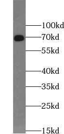 anti-Aggrecan antibody