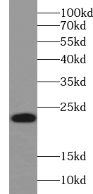      anti-ABHD14B antibody