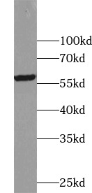 anti- ALDH1A3 antibody