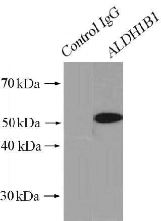      anti- ALDH1B1 antibody