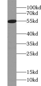      anti- ALDH1B1 antibody