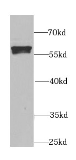      anti- ALDH1A2 antibody