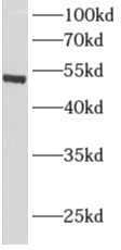      anti- ALDH1A1 antibody