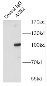ACE2抗体