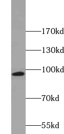 anti- ACE2 antibody