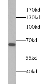      anti- ABLIM2 antibody