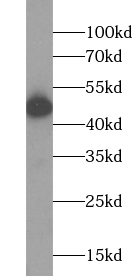      anti- AADAT antibody