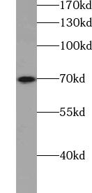      anti- ACK1 antibody