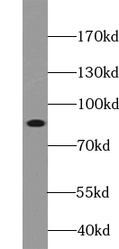 anti- ABLIM1 antibody