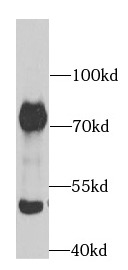      anti-ACHE antibody