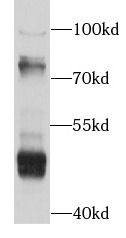 anti- ACOX1 antibody