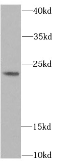 anti- ACP1 antibody