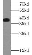 anti- ACP5 antibody