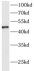      anti- ACP6 antibody