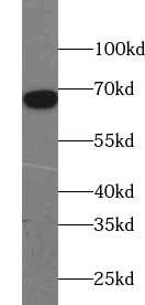      anti- ACOT11 antibody