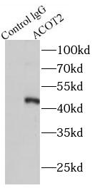      anti- ACOT2 antibody