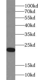      anti- ACOT6 antibody