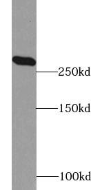 anti- ACC1 antibody