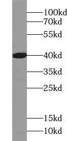      anti-ACOT7 antibody