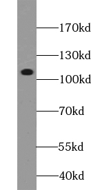 anti- ACAD10 antibody 