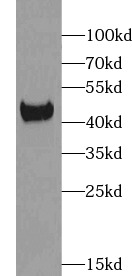      anti- ACADS antibody