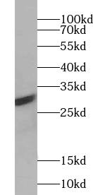      anti- ABT1 antibody