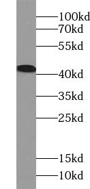      anti- ACAT2 antibody