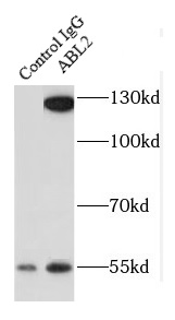      anti- ABL2 antibody