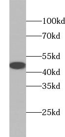 anti-ACAT1 antibody