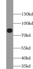      anti- ACAP1 antibody