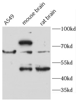      anti- ACADVL antibody