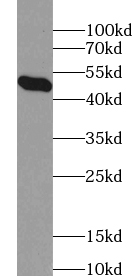      anti- ACADSB antibody