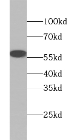 anti- ABI2 antibody