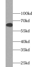 anti- ABCG4 antibody