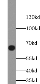 anti- ACBD3 antibody