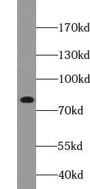      anti- ABCB10 antibody